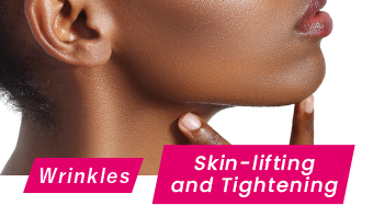 Skin-lifting and Tightening